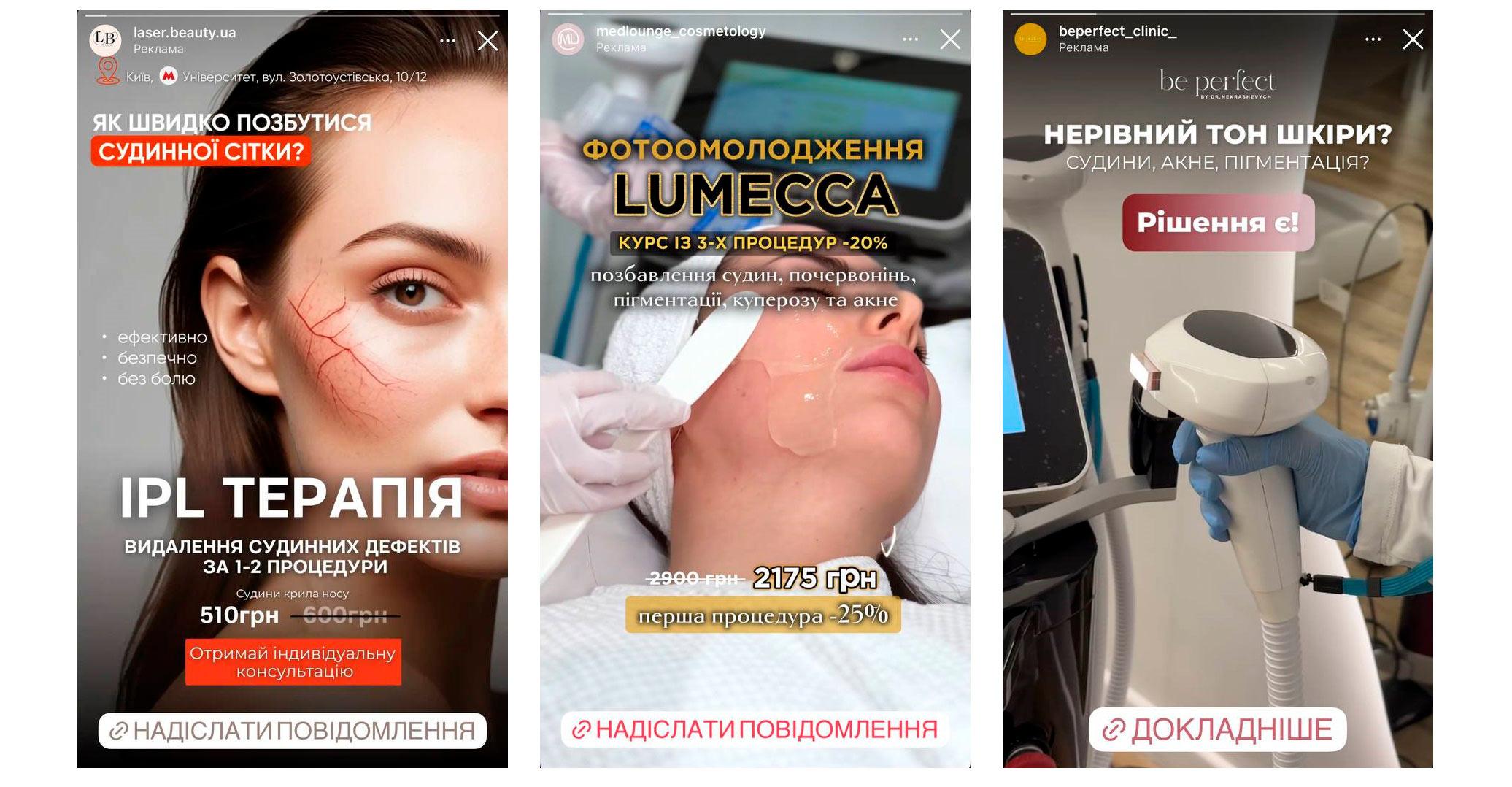 реклама на підписників конкурентів